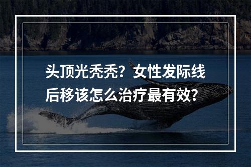 头顶光秃秃？女性发际线后移该怎么治疗最有效？